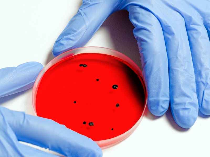 Pestilence = Monkeypox Pt&nbsp;1